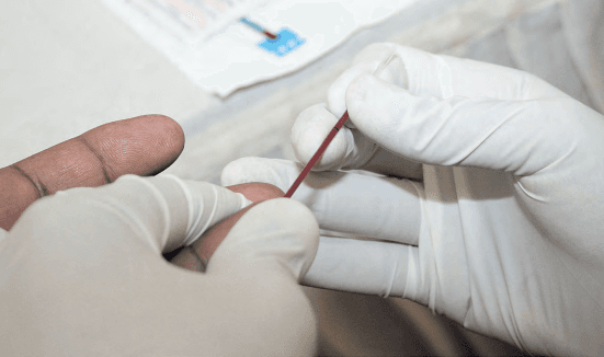 Go for HIV testing and treatment early, men told